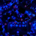 【Buy One Get One Equal Volume For Free】Neon Bikini Nail & Beads Mix-glow(miki)- NailC