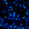 【Buy One Get One Equal Volume For Free】Garden Nail & Beads Mix-glow(miki)- NailC